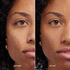 Skin Solution