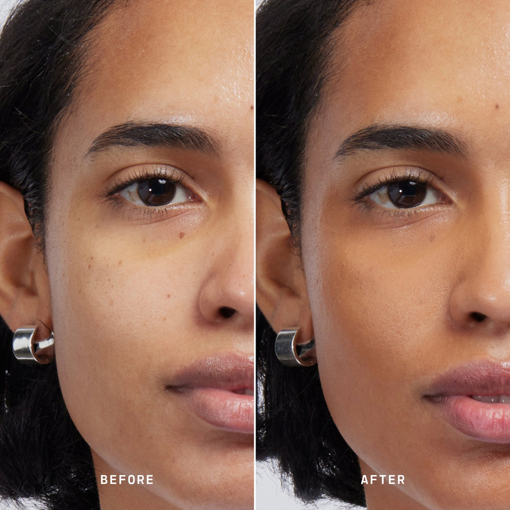Skin Solution