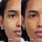 Skin Solution