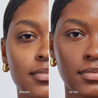 Skin Solution