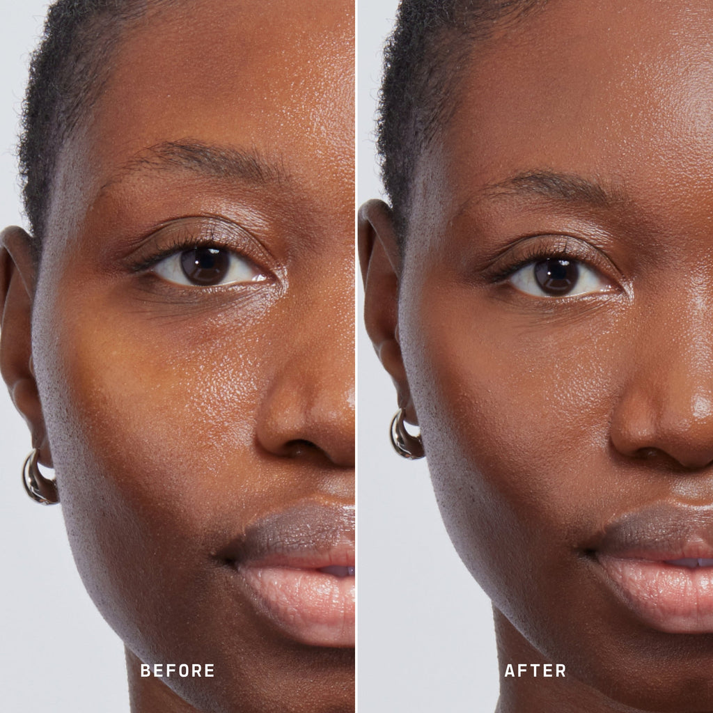 Skin Solution