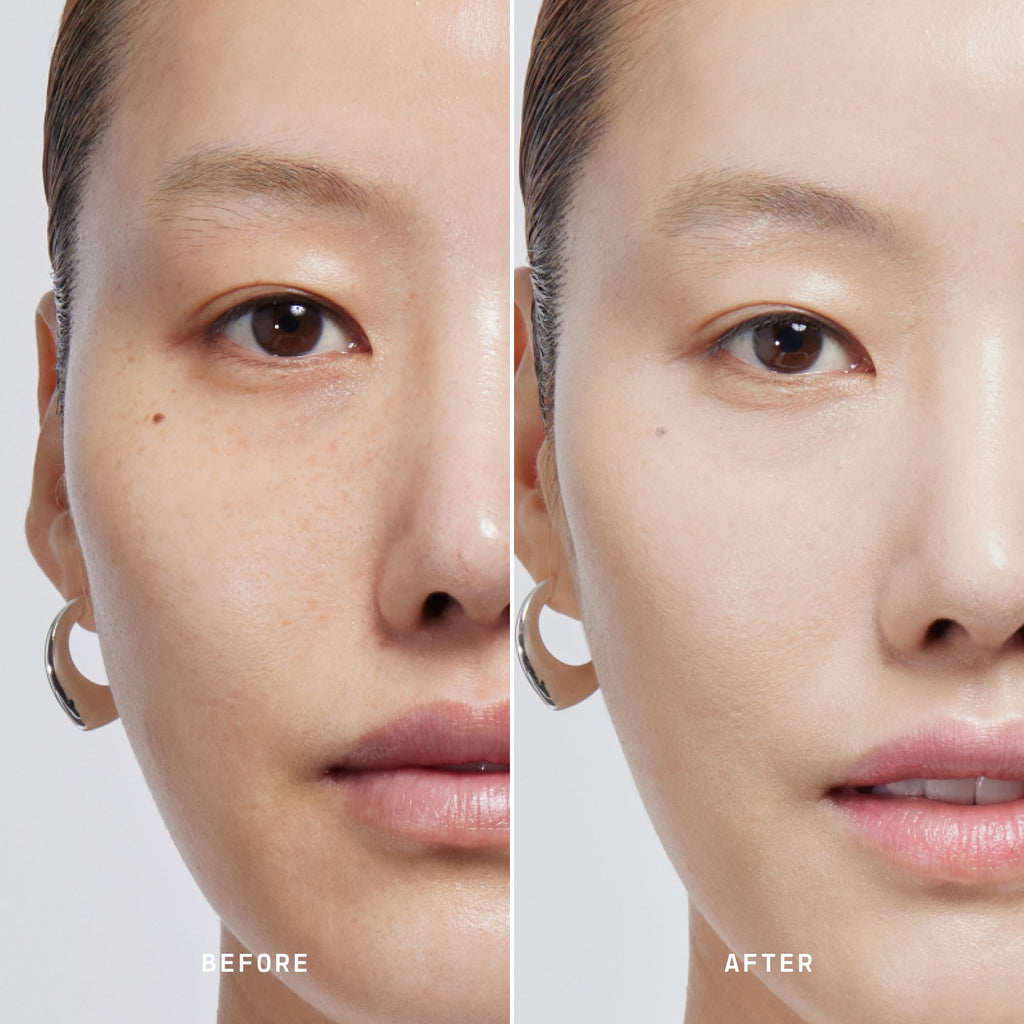 Skin Solution