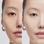 Skin Solution