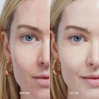 Skin Solution