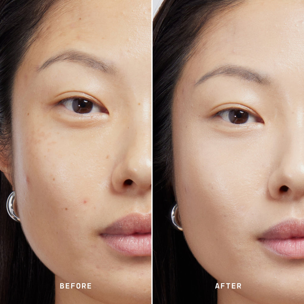 Skin Solution