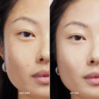 Skin Solution