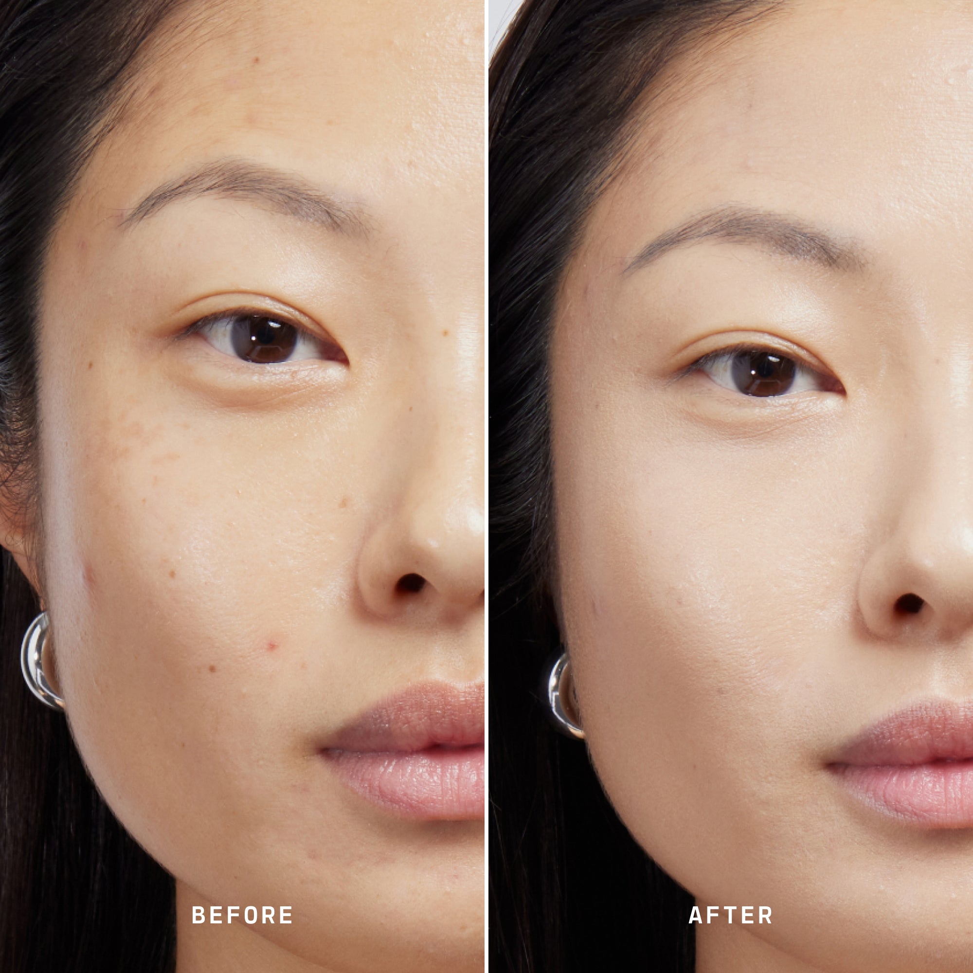 Skin Solution