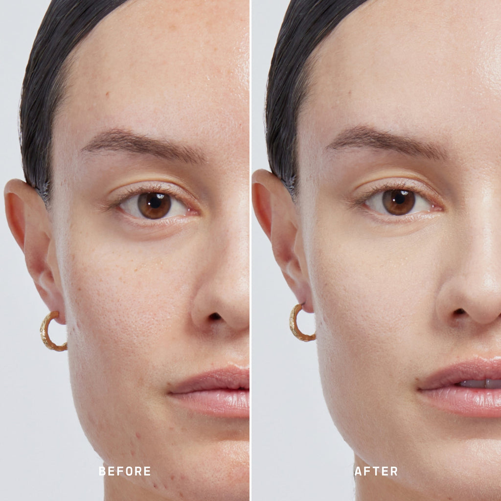 Skin Solution