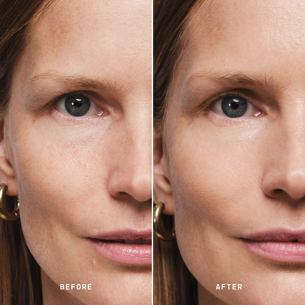 Skin Solution