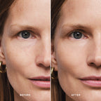 Skin Solution