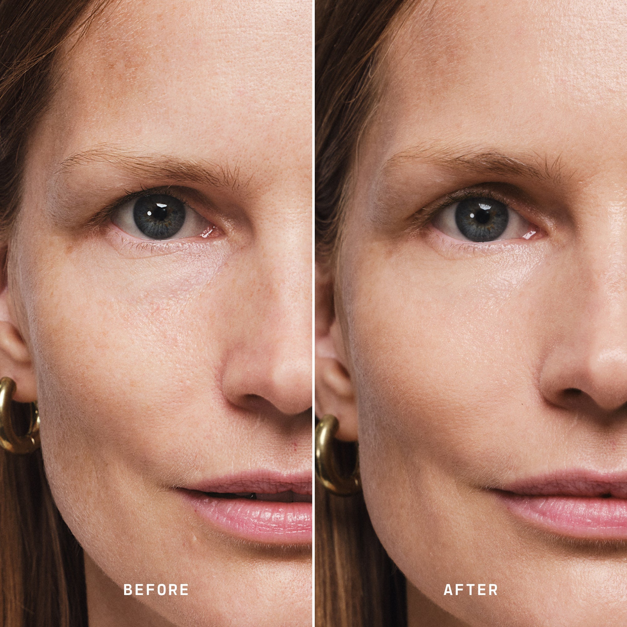 Skin Solution