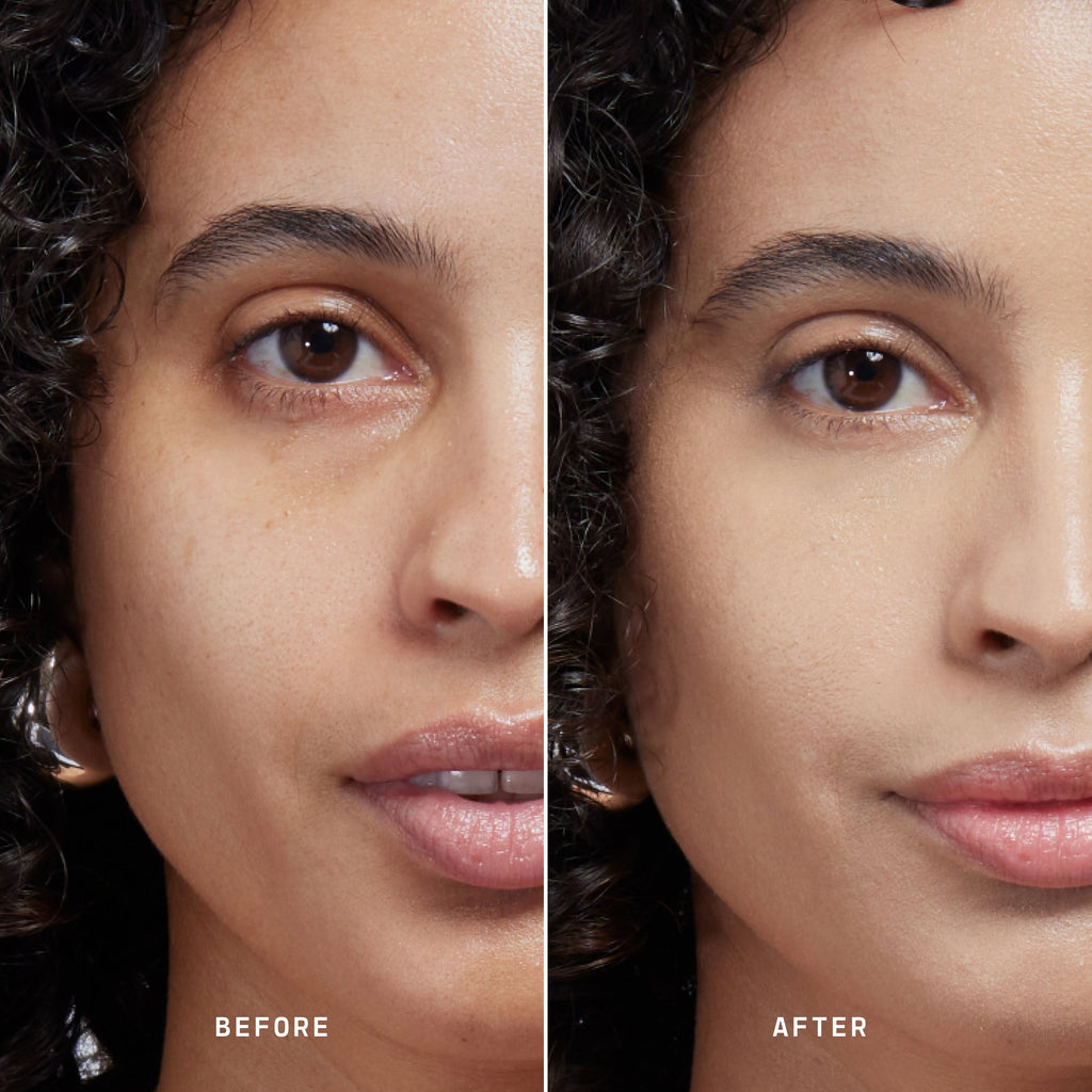 Skin Solution
