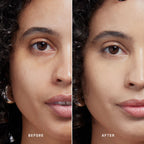 Skin Solution