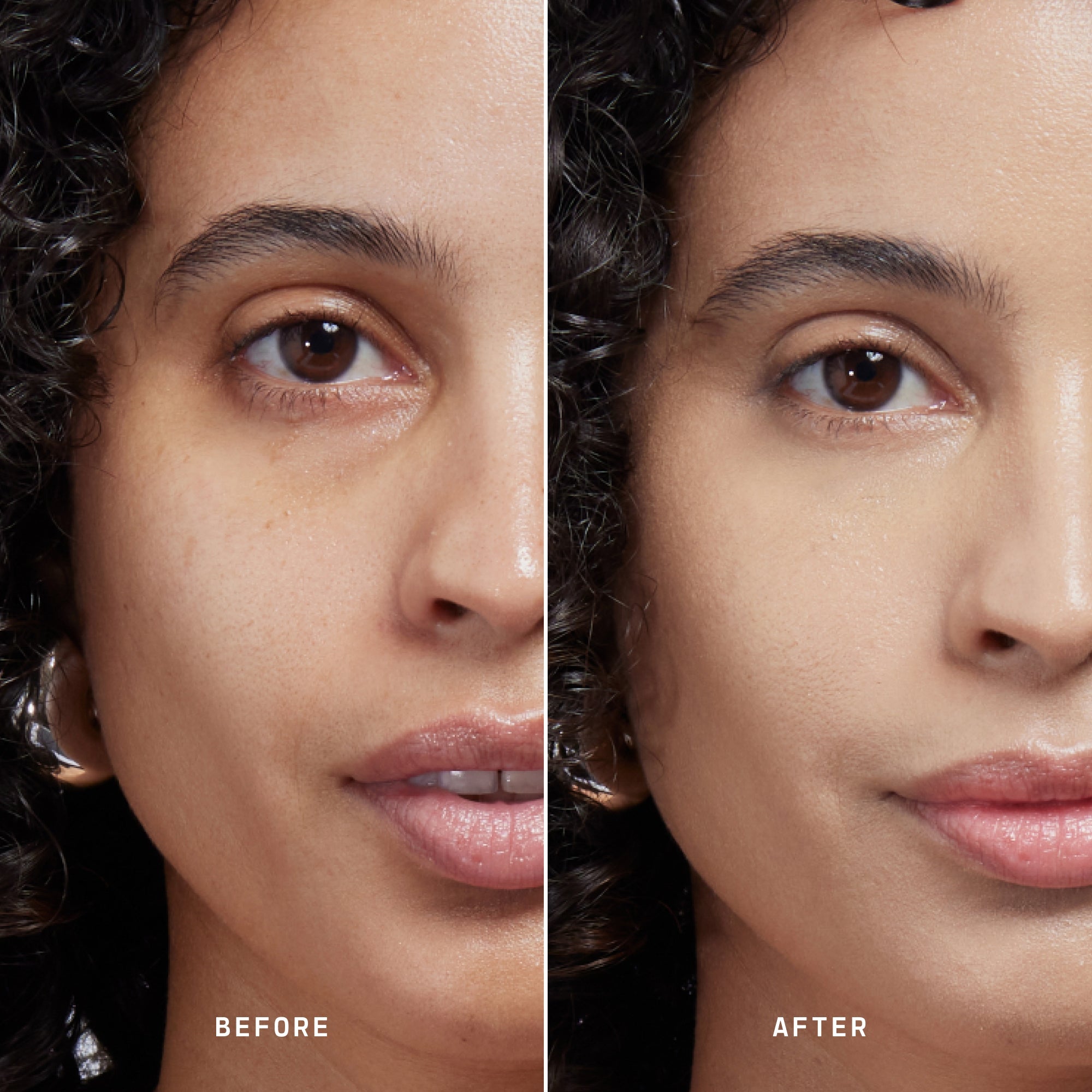 Skin Solution