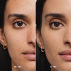 Skin Solution