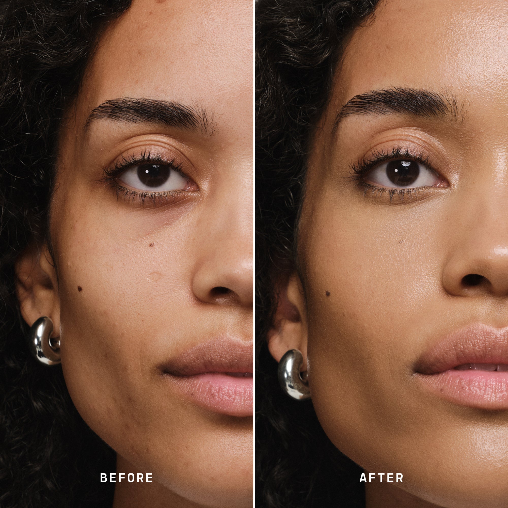 Skin Solution