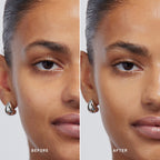 Skin Solution
