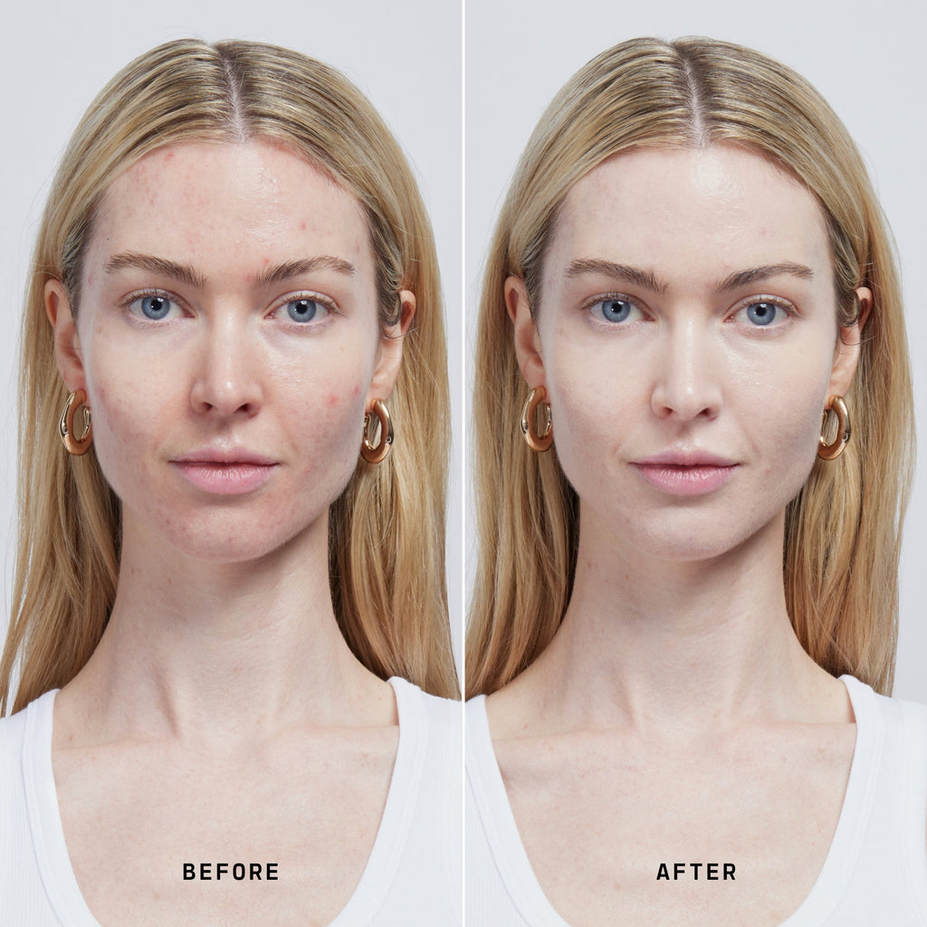 Skin Solution