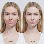 Skin Solution