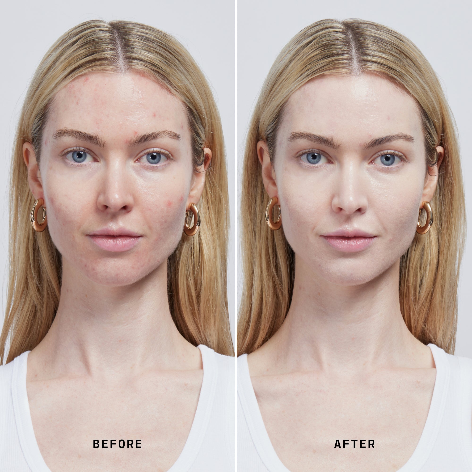 Skin Solution
