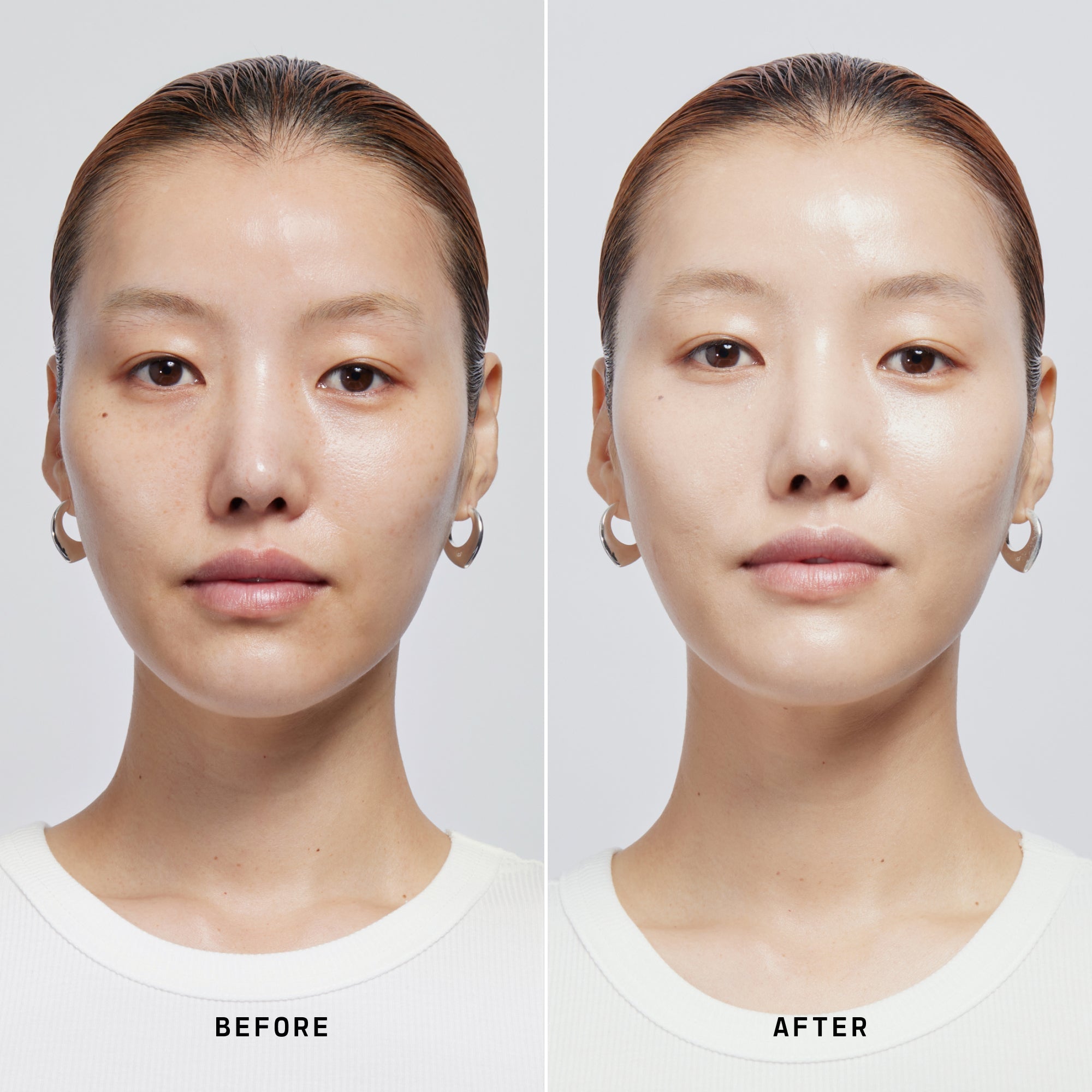 Skin Solution