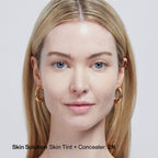Skin Solution