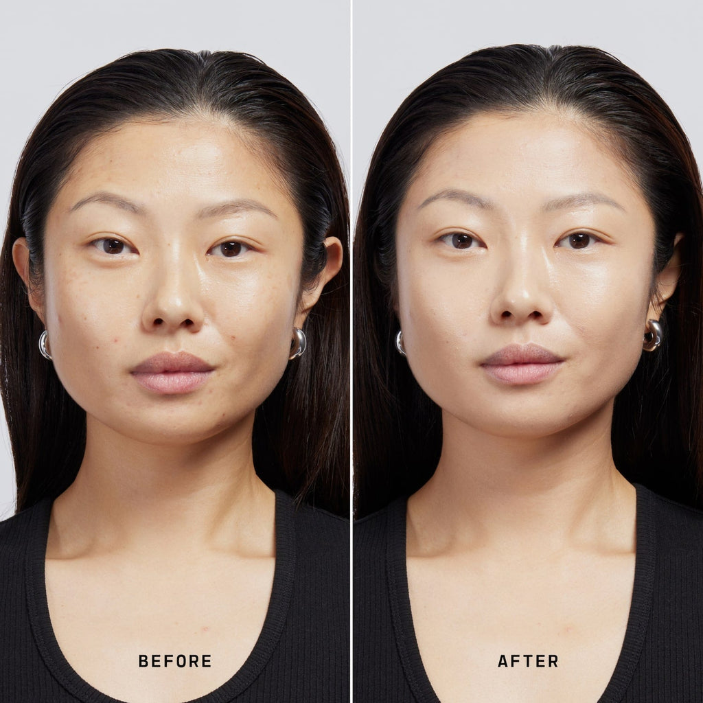 Skin Solution
