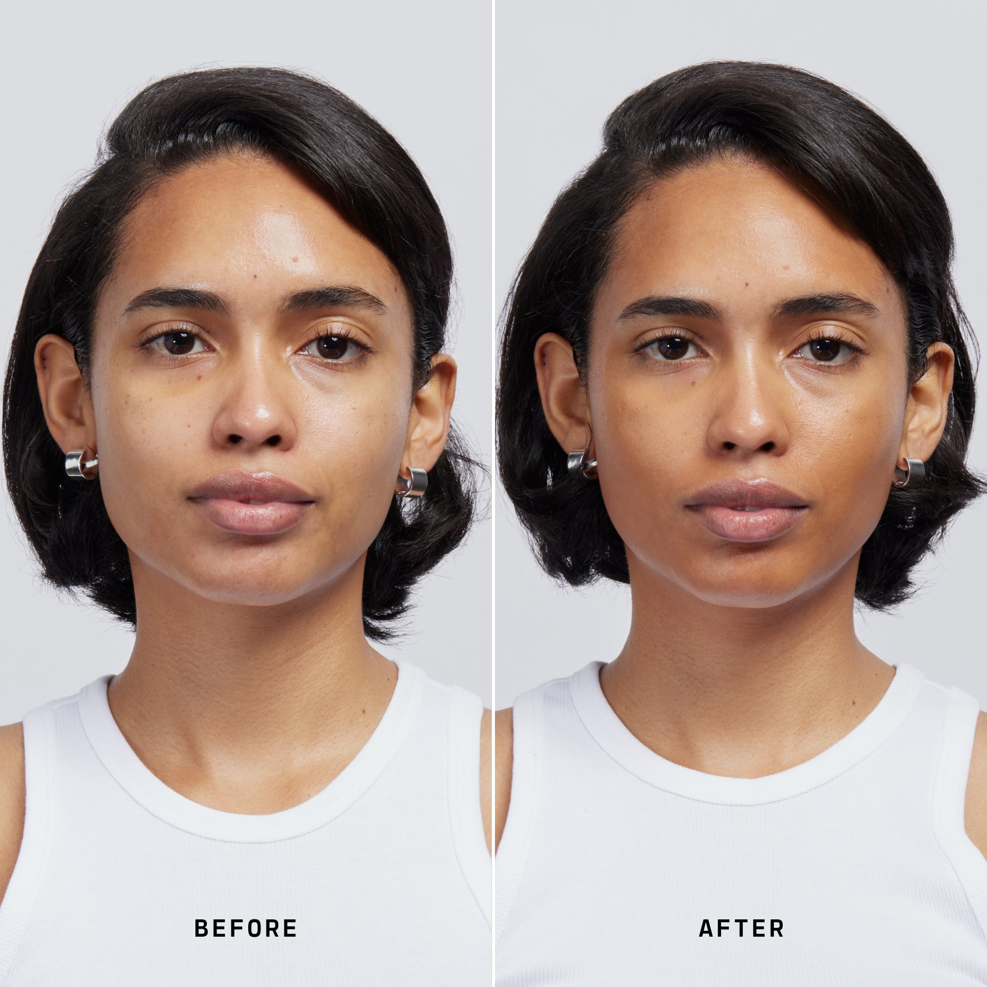 Skin Solution