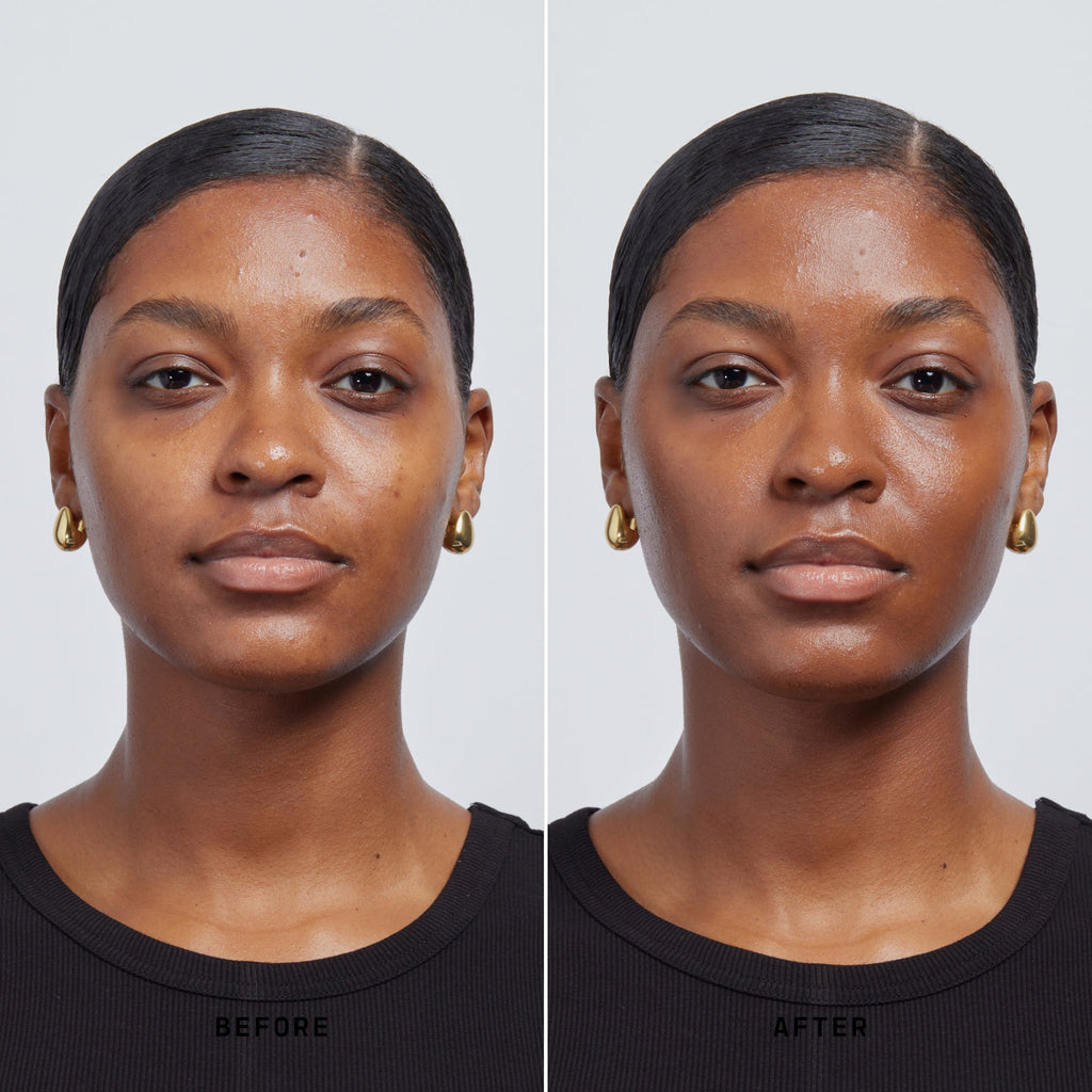 Skin Solution