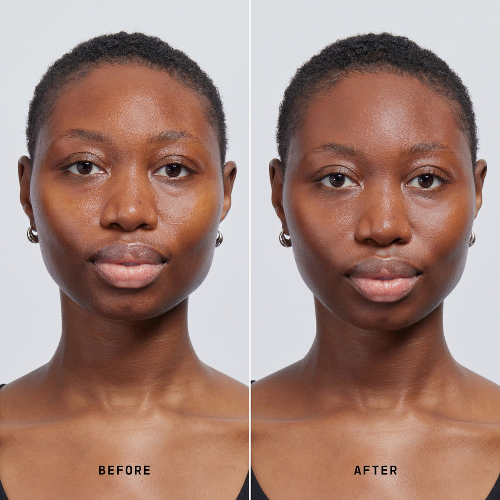 Skin Solution