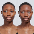 Skin Solution