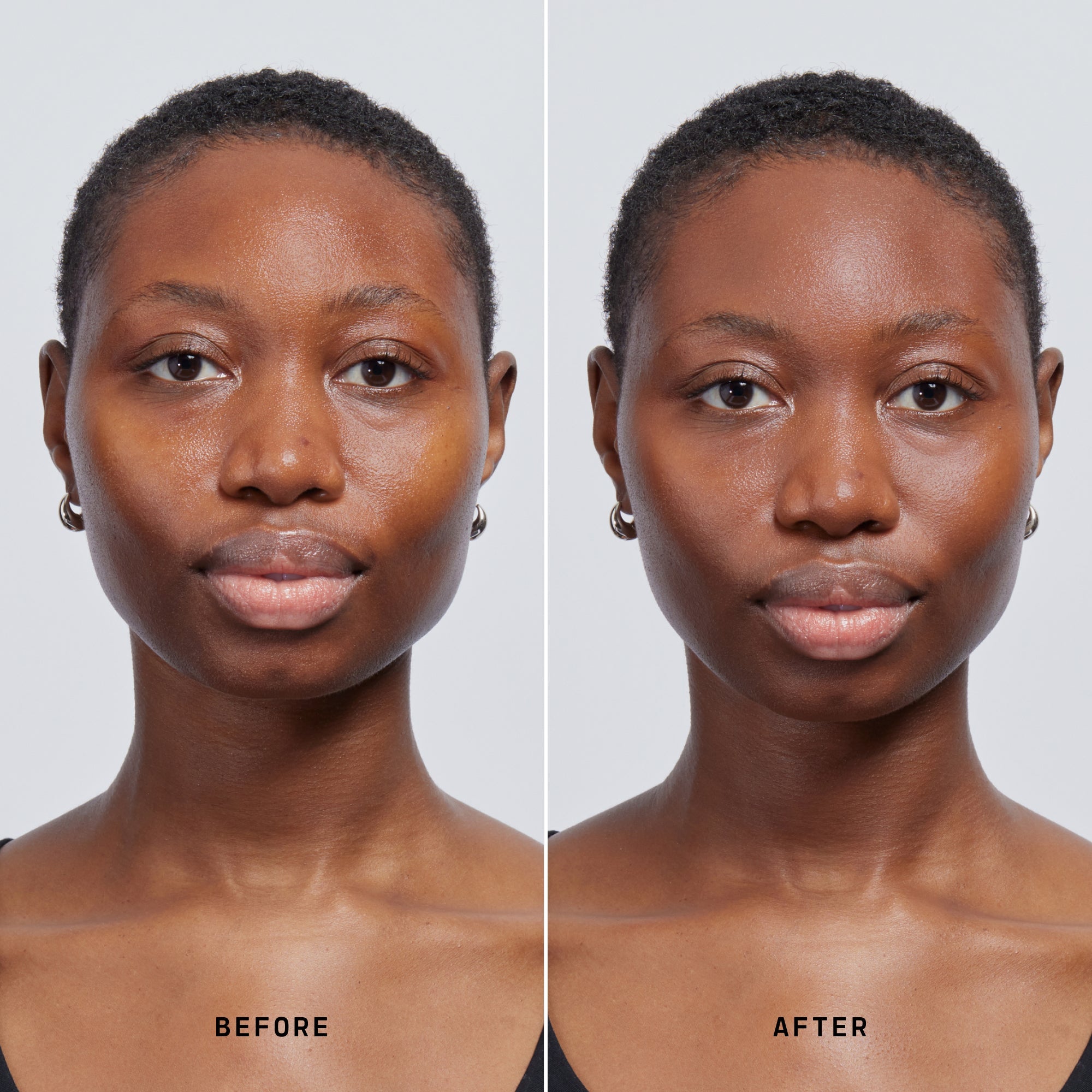 Skin Solution