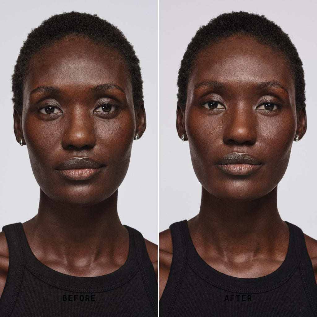 Skin Solution