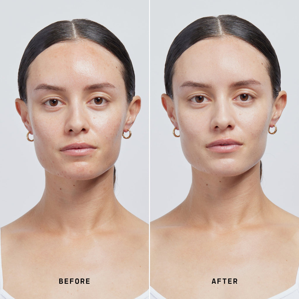 Skin Solution