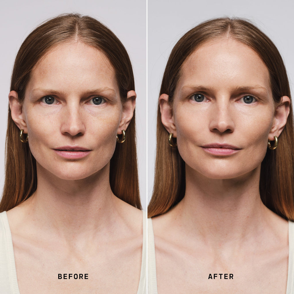 Skin Solution