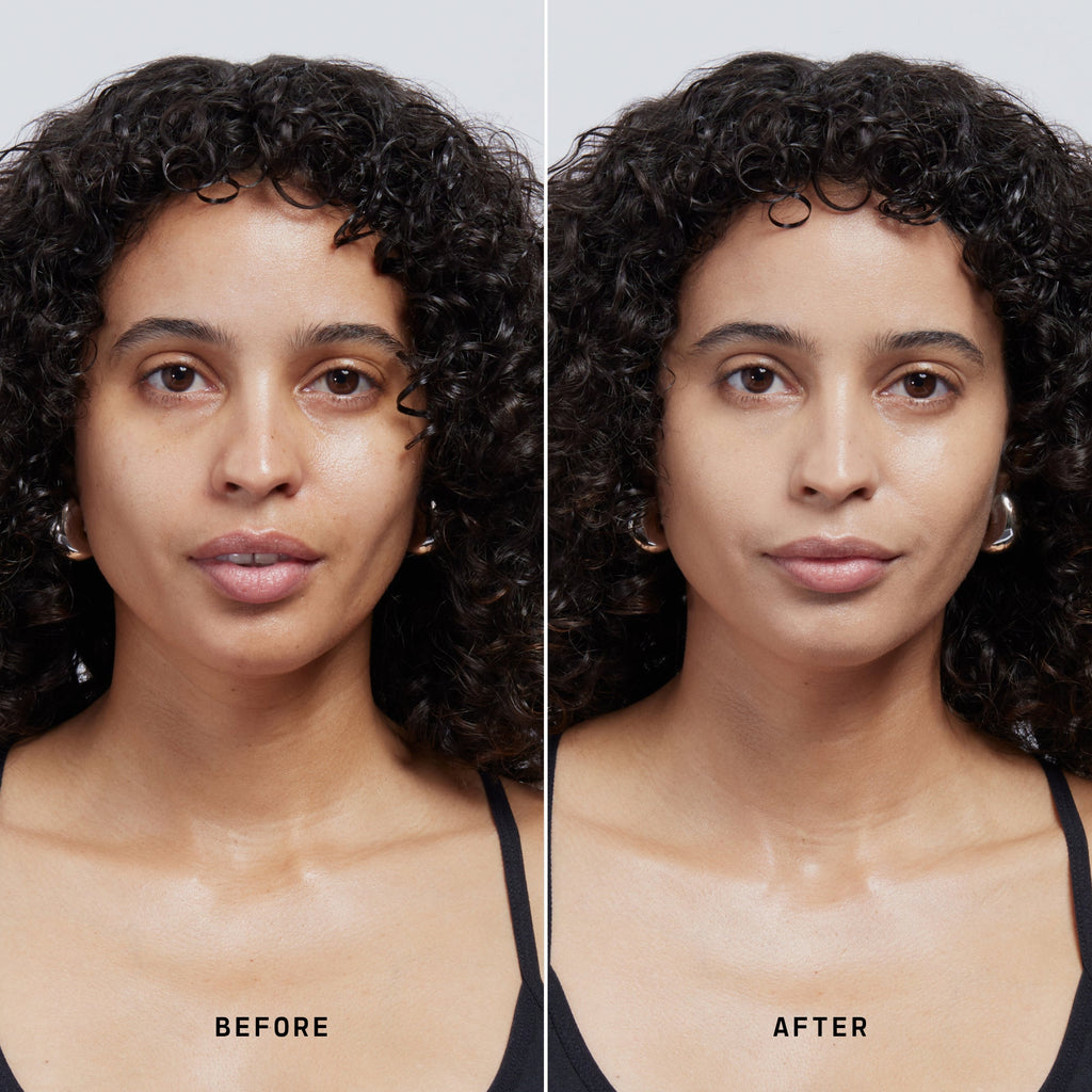 Skin Solution