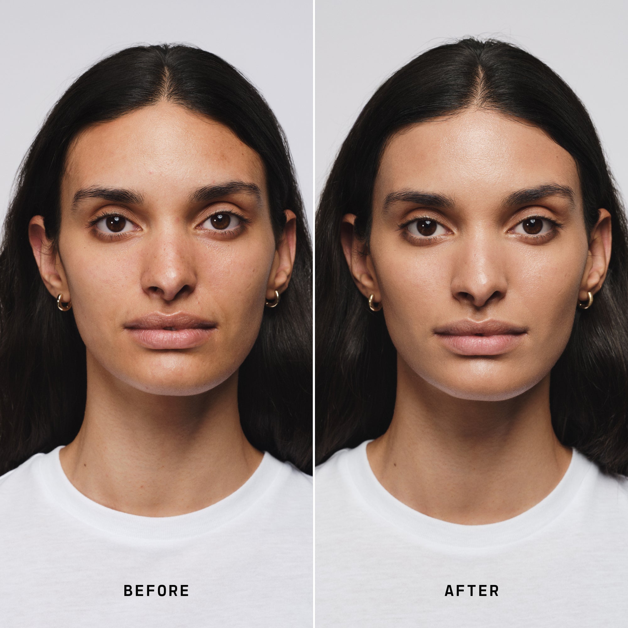 Skin Solution