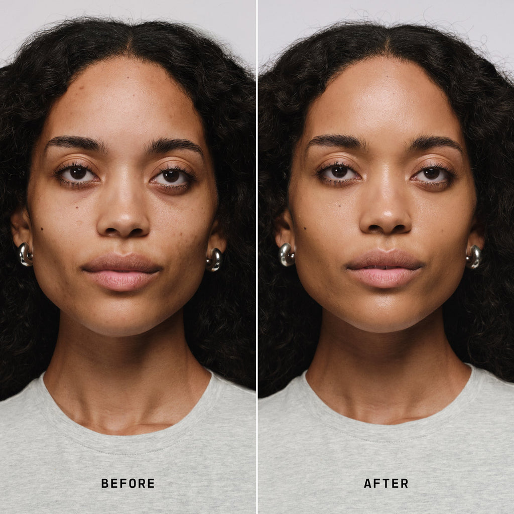 Skin Solution