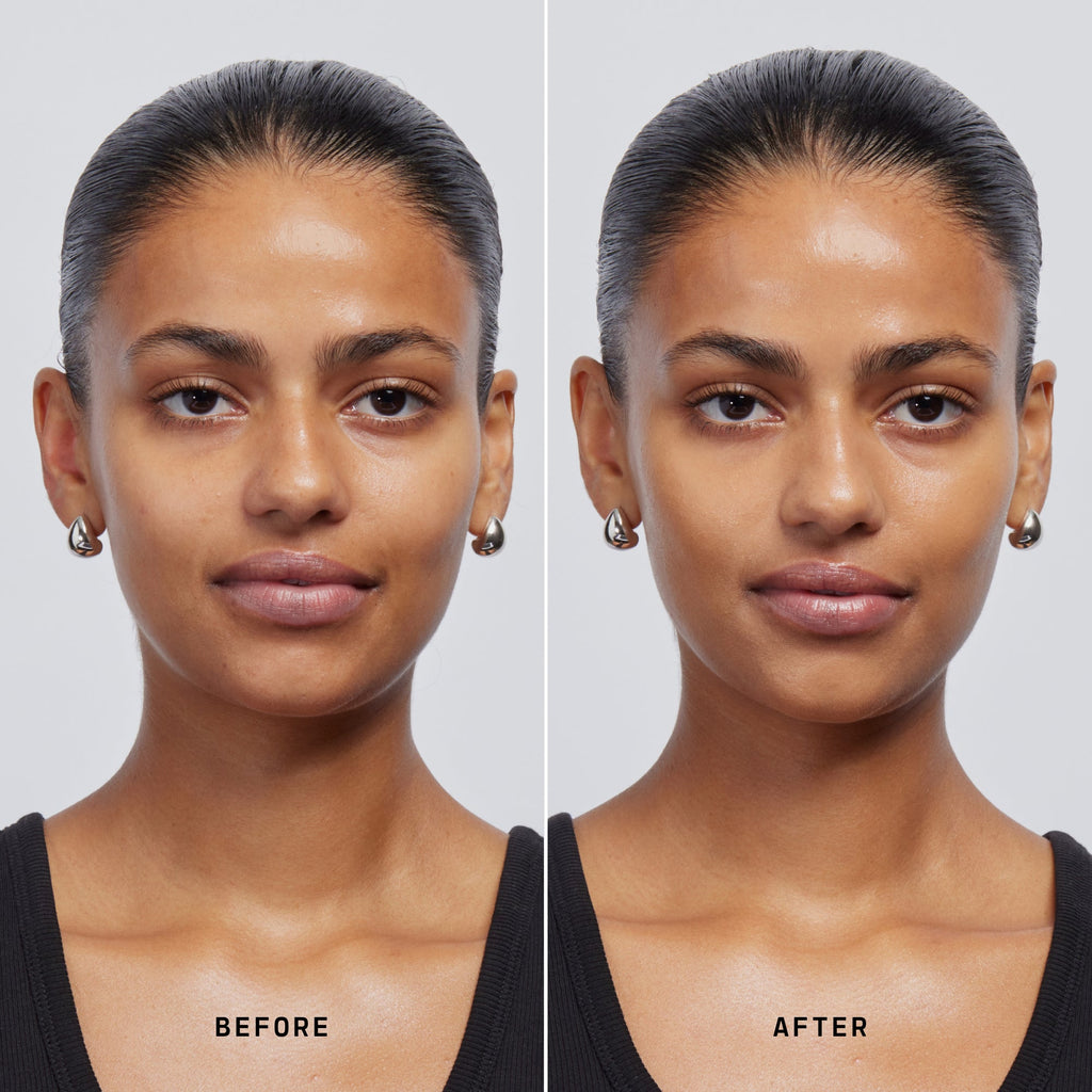 Skin Solution