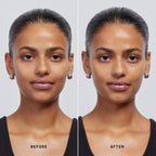 Skin Solution